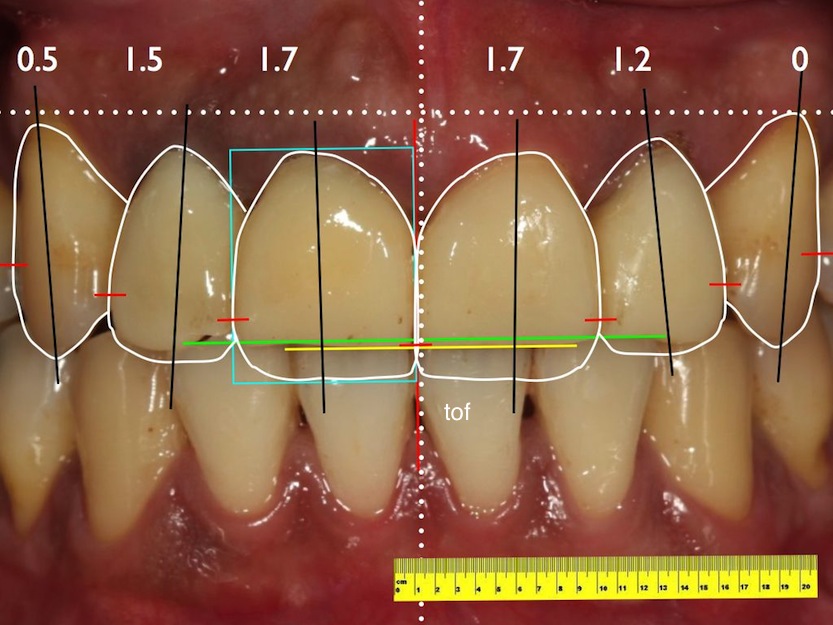 DSD figure.005.jpg DSD figure 005