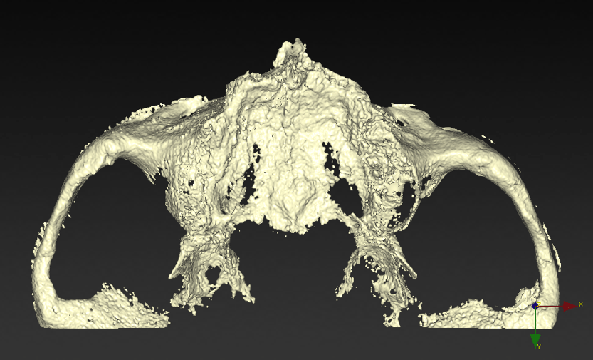 extremely absorbed maxilla occlusal.png Extremely absorbed maxilla occlusal