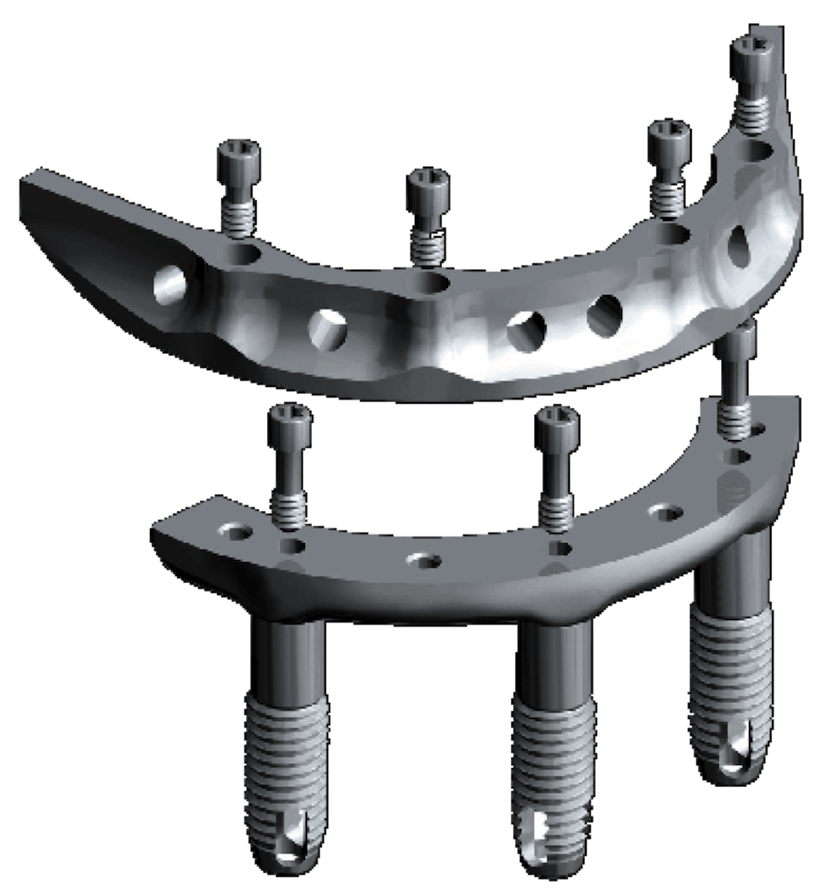 Branemark system Novum