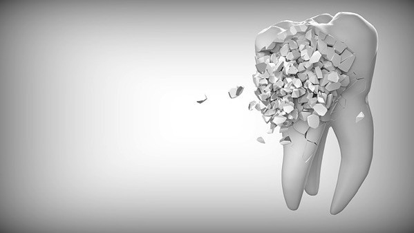 Tooth 2874551 640