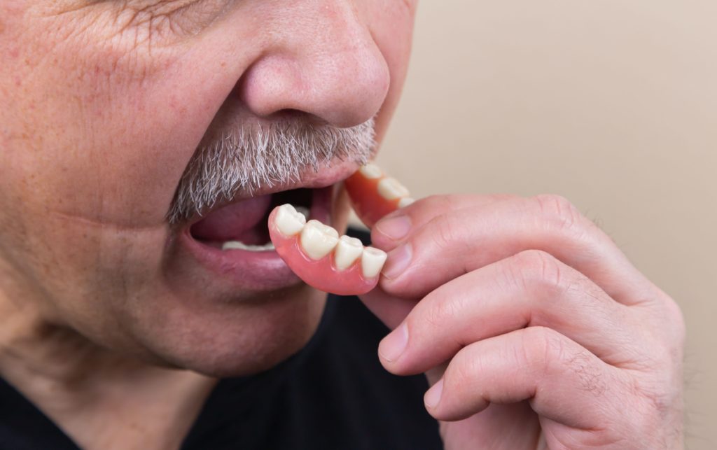 使用活動假牙容易鬆脫、進食困難。