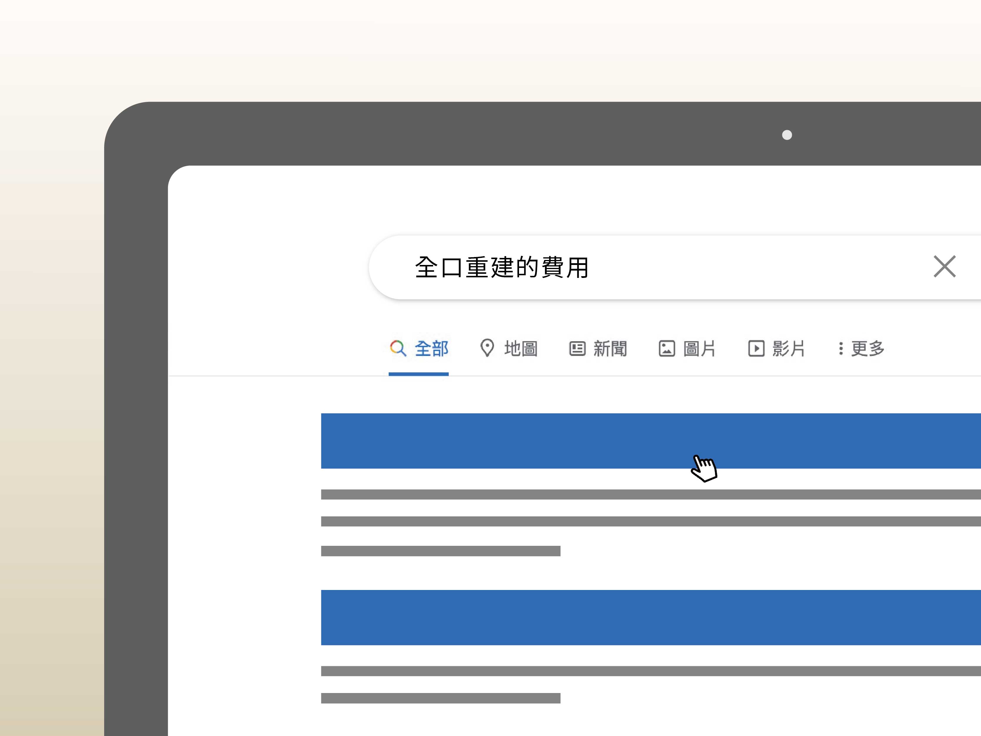 37萬全口重建